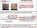 마이크로니들 화장품 ‘허위·과대광고’ 82건 적발