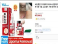 '쥐젖 제거' 불법 인터넷 유통·판매 569건 적발